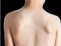 瑜伽越练肩膀越僵硬咋回事,肩膀厚练瑜伽可以改变吗