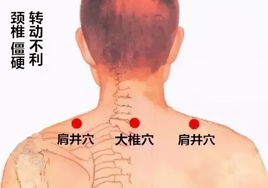 脖子一转筋咔咔响,脖子一转咔咔响