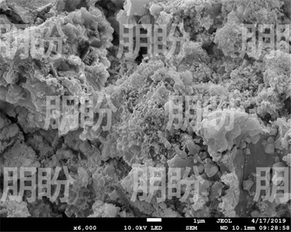 结晶和结石的区别是什么,结晶vsd