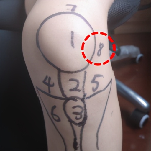 骨科医生教你一招搞定膝盖痛,不同部位膝关节