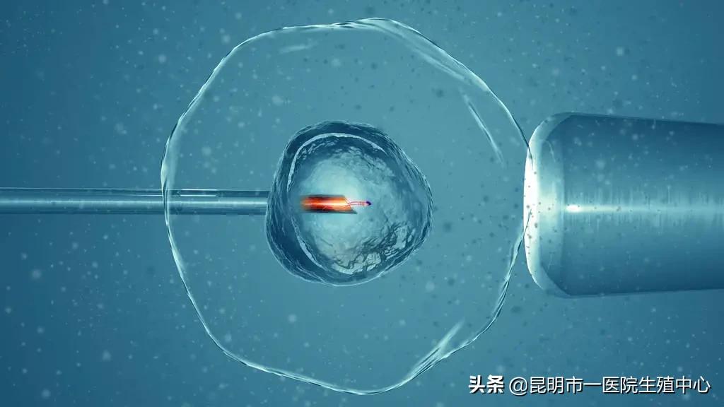 性激素六项是什么检查有必要做吗,女性性激素六项检查时间