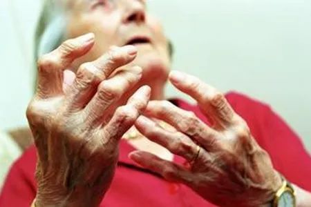 类风湿关节炎有哪些症状？日常生活中如何养护？