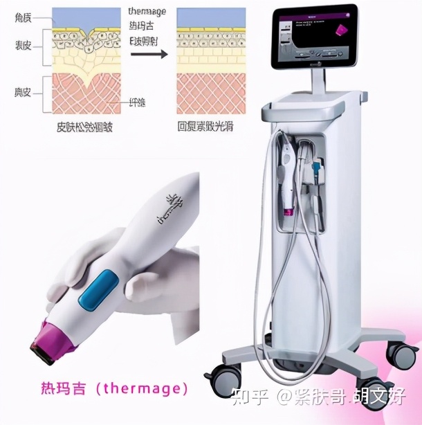 哪些人群不适合做热玛吉?