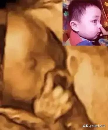 孕期产检必做的几大项,孕期第几周检查大排畸