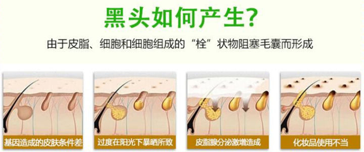 鼻子黑头去除后怎么收缩毛孔,鼻头黑头收缩毛孔用什么