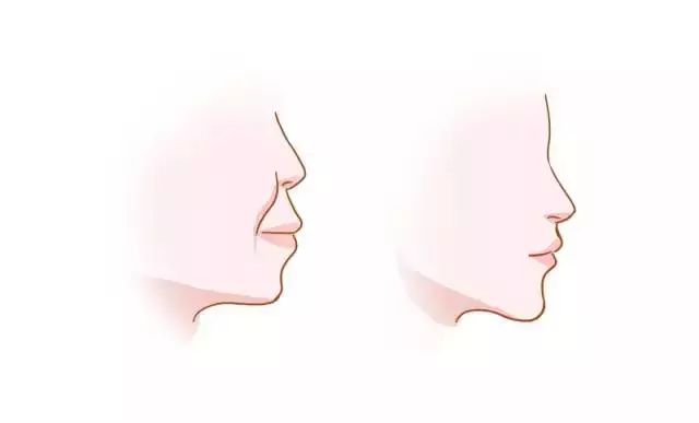 一分钟带你看牙齿矫正的全过程,最常见的牙齿矫正问题速度收藏