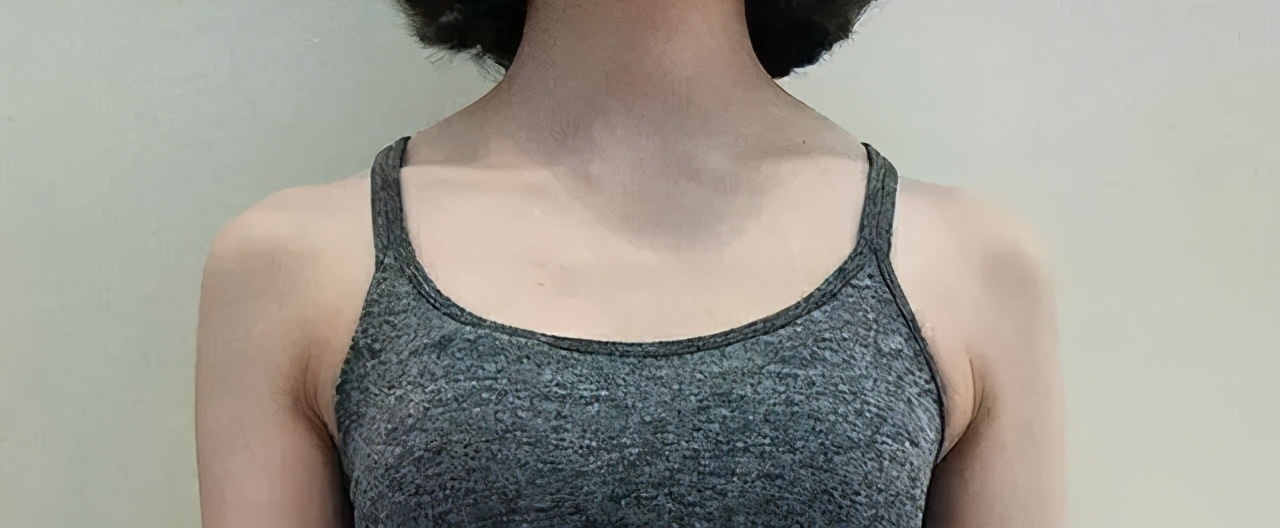 高低肩改善训练,10分钟缓解肩颈酸痛,消除斜方肌高耸