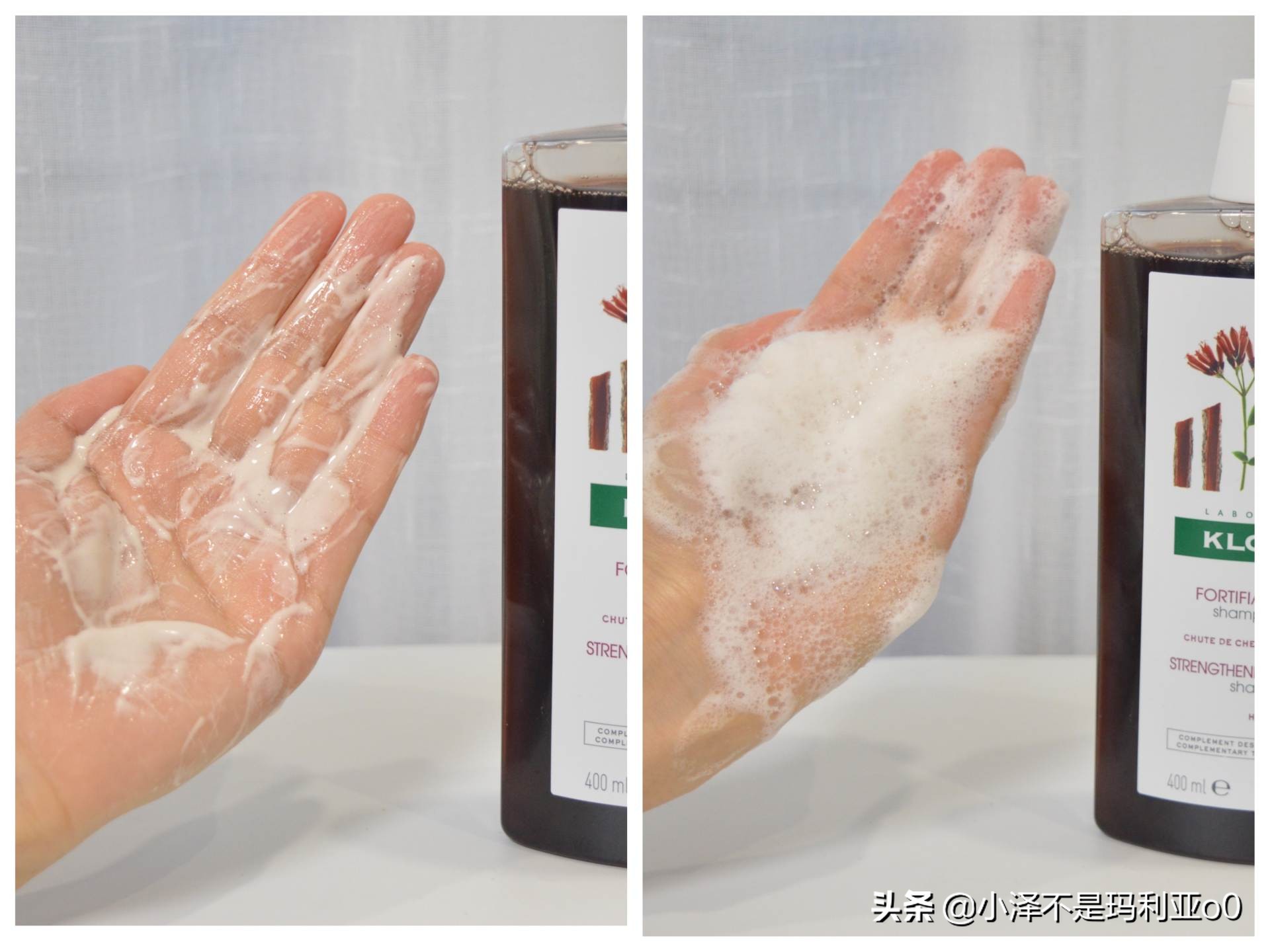 额头秃发际线后移适合什么洗发水,拯救发际线的洗发水