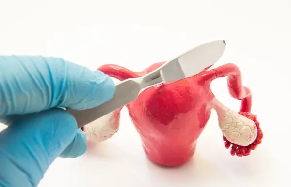 子宫不切有病变怎么办呢,子宫不锥切能行吗