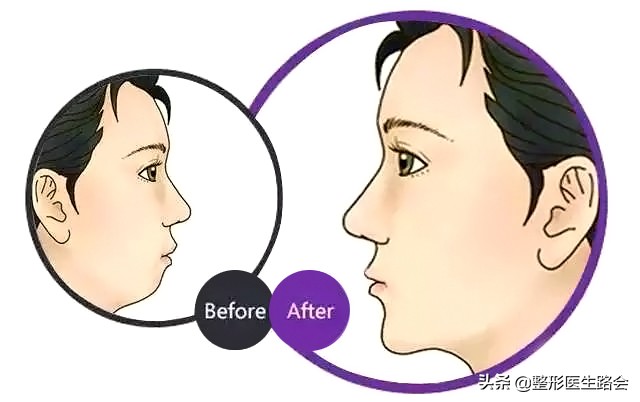 为什么侧颜没有下巴轮廓,侧颜怎么p下巴