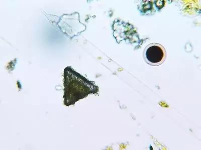 鱼类水产养殖需要哪些藻类,水产养殖显微镜下各种藻类