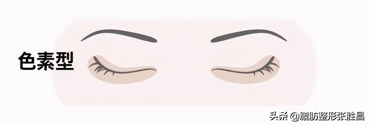 失眠黑眼圈重喝什么比较好,失眠黑眼圈怎么快速消除