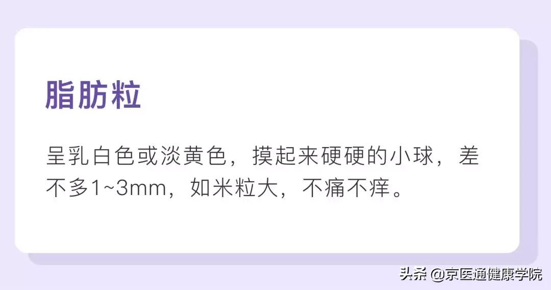 粟丘疹汗管瘤扁平疣区别,粟丘疹和汗管瘤区别