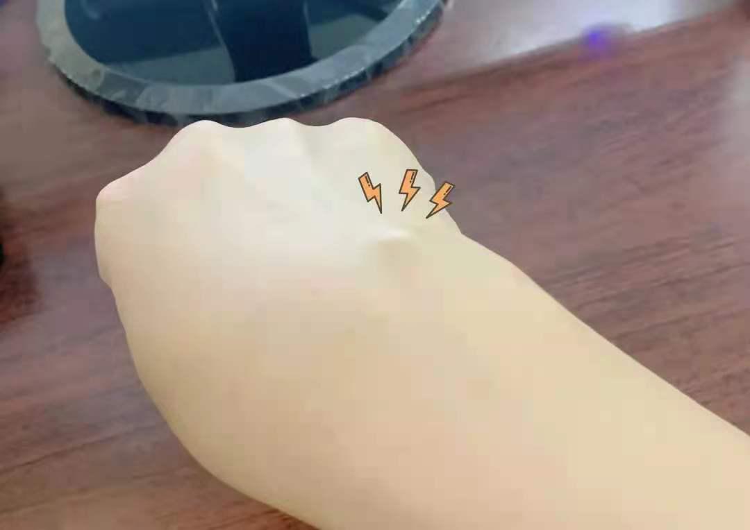 手上长个包不痛不痒会不会是肿瘤,手上长了个肿块