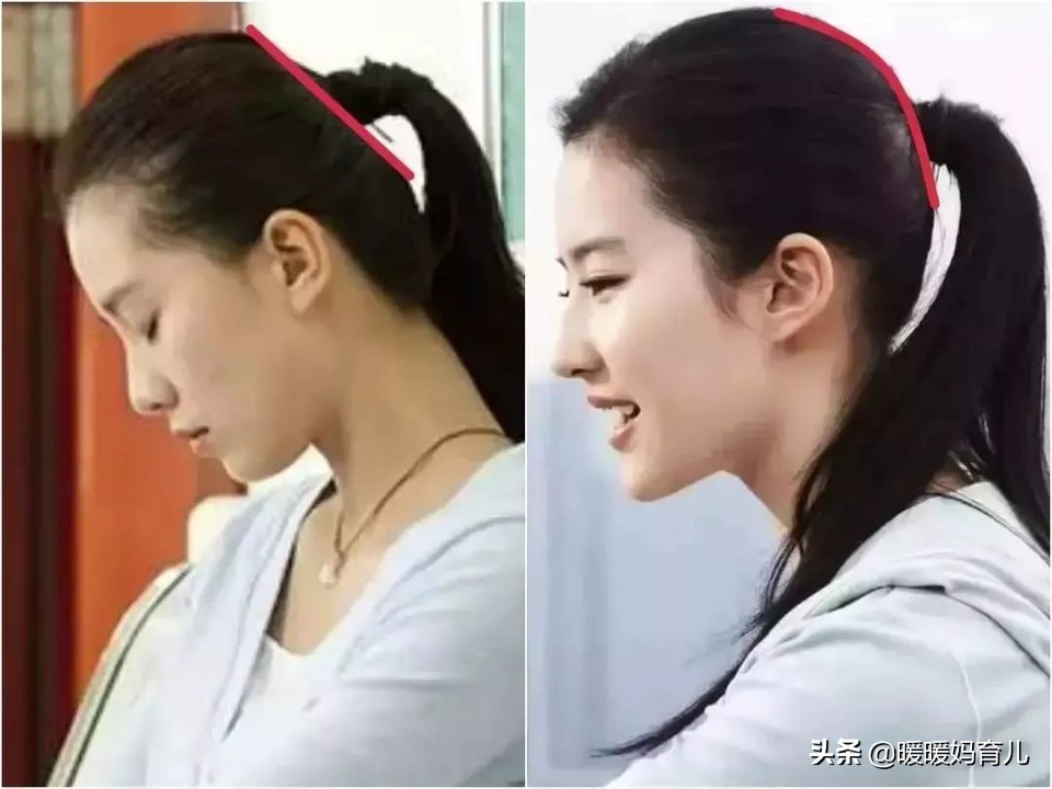 婴儿头型尖真的好丑,宝宝头型不好看是天生的么