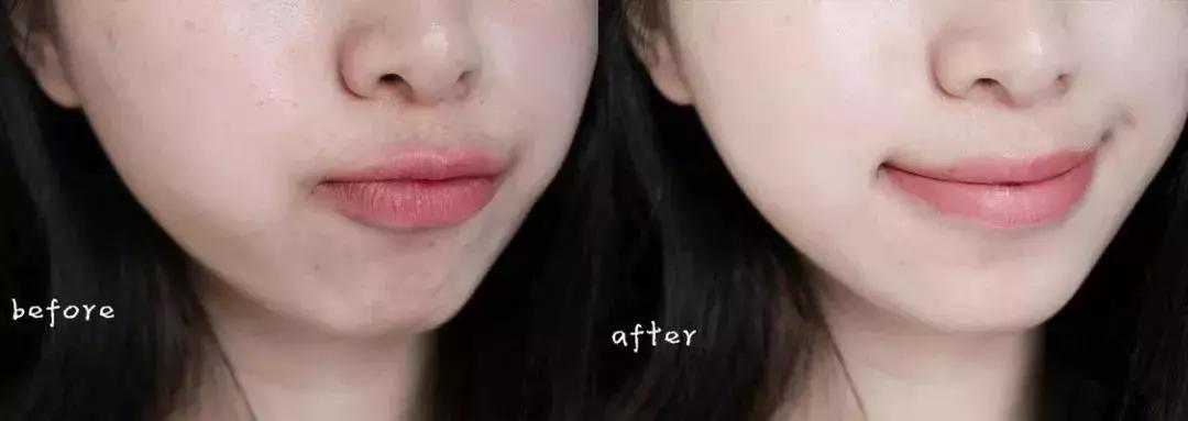 德国安娜柏林旗舰店,安娜柏林双蜜精华