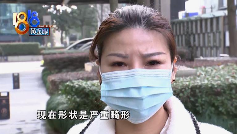 取耳软骨垫鼻尖效果图,取软骨垫鼻后软骨长什么样