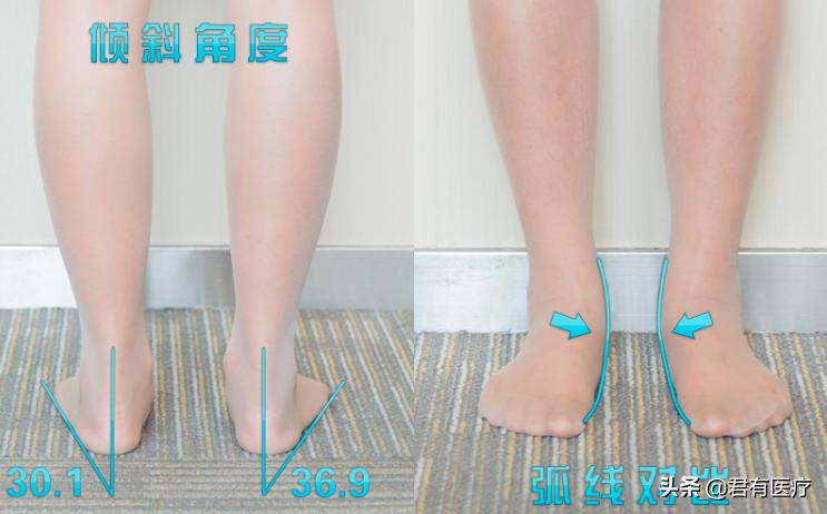 膝关节无力中医治疗方法,老年人膝关节无力治疗
