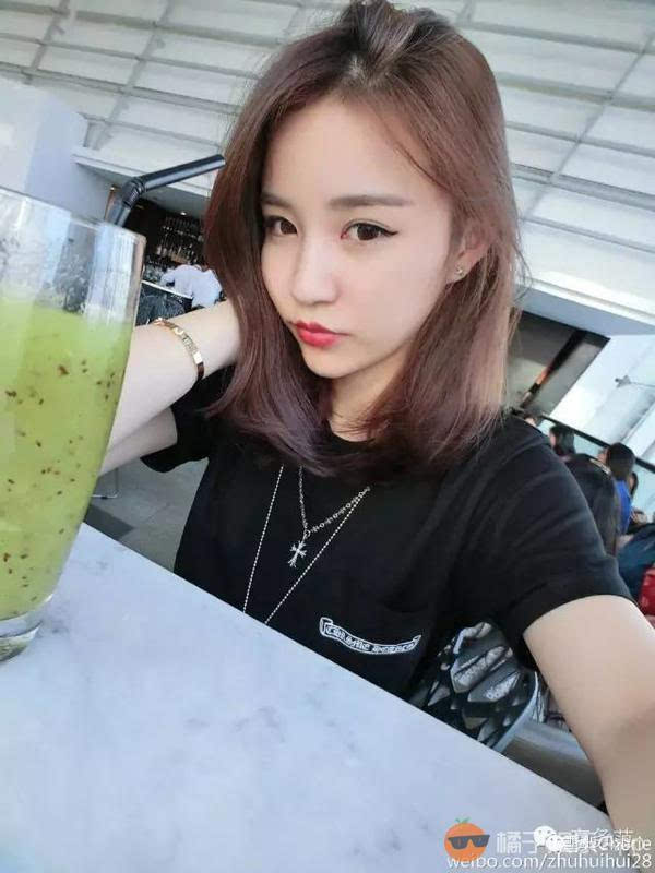 网红玻尿酸,为什么网红都打玻尿酸