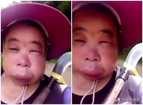 被蜜蜂蛰了怎么办家庭处理方法,被蜜蜂蛰了怎么办最简单