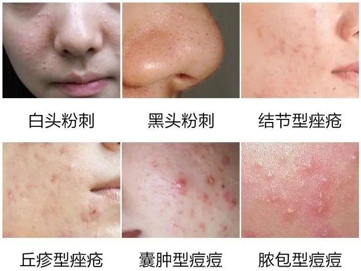 瑞迪福森净水器,超滤净水器种草