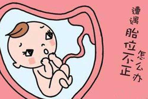 顺产时发现胎位不正怎么处理,产前胎位不正怎么办怎么样能调