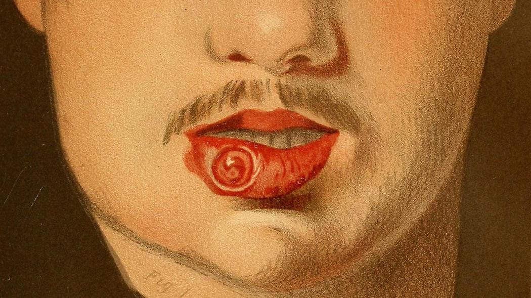 梅毒这个病是怎么形成的,梅毒是怎么出现在人类身上