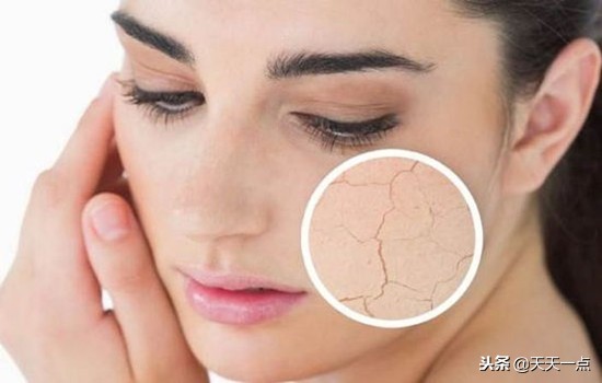 为什么换季皮肤老是起皮,为什么一换季皮肤就干