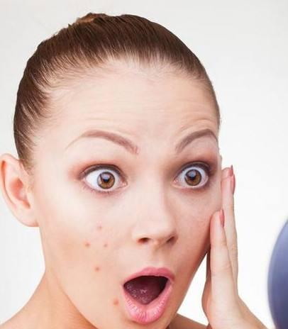 怎样有效消除脸上的痘痘,怎样去除脸上的痘痘和痘印