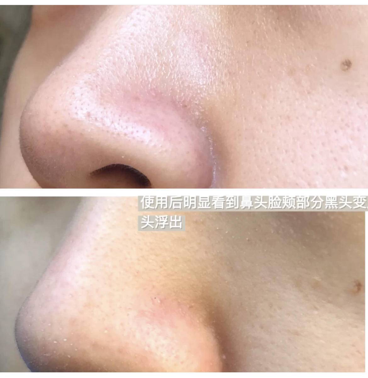 为什么同样的面膜有的人干得快,为什么美容院敷面膜效果好呢