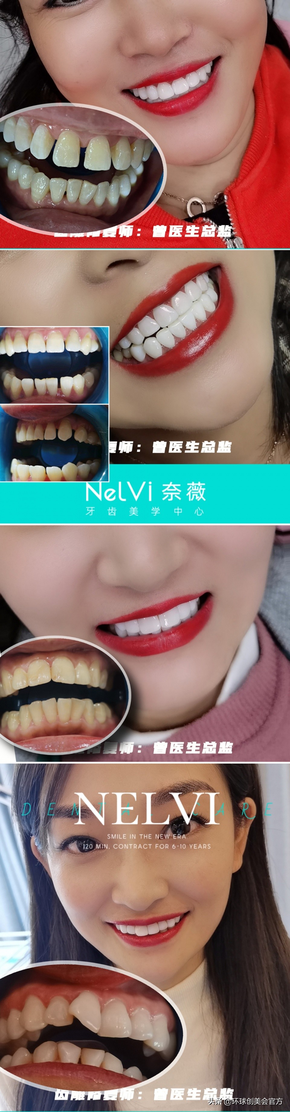 口腔美学高级修复师,世界口腔美学修复大师