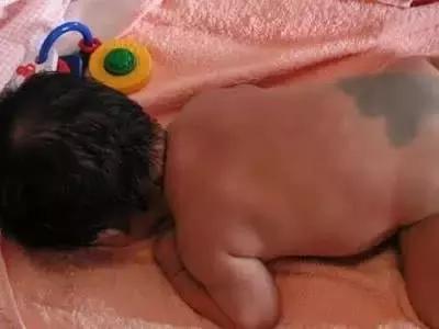 祛斑面诊必背知识点,要祛斑