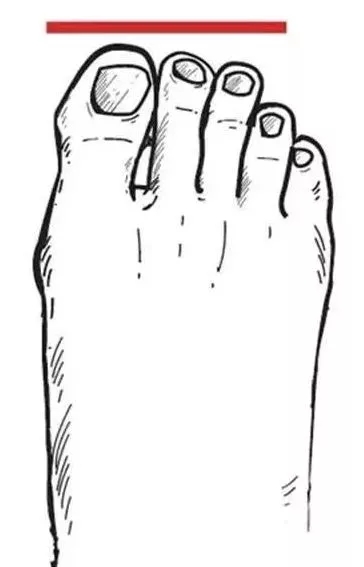 你的脚是正常脚型吗,你的脚型属于哪种呢