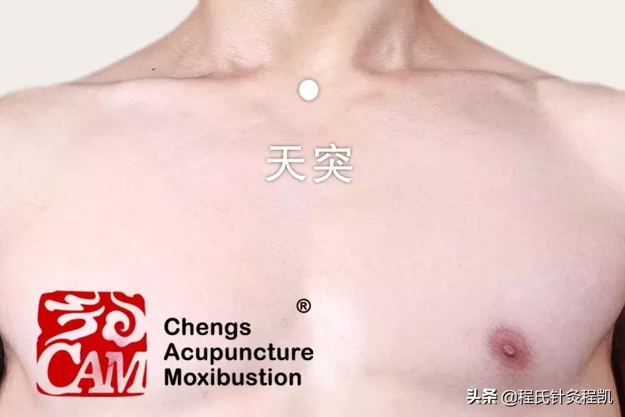 喉咙异物感有慢性咽喉炎怎么消退,喉咙异物感慢性咽炎吃什么药