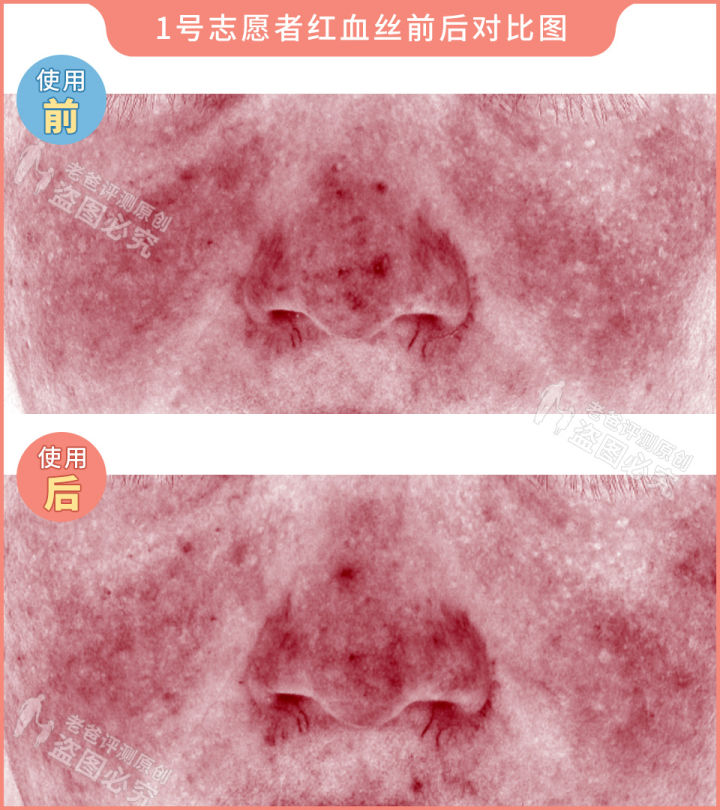 300块的网红美容仪有效果吗,网红家用美容仪测评