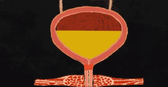 那位死于憋尿的名人也太苦逼了吧