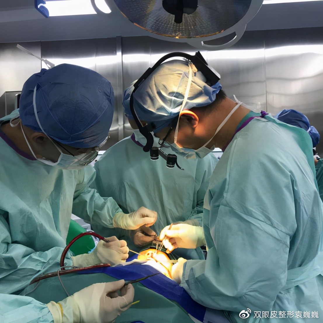 单眼皮怎么贴出平行双眼皮,单双眼皮现实中好看吗