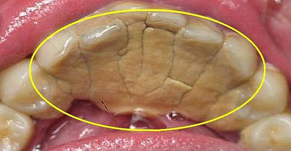 牙科诊所里你不知道的事,口腔医生提醒