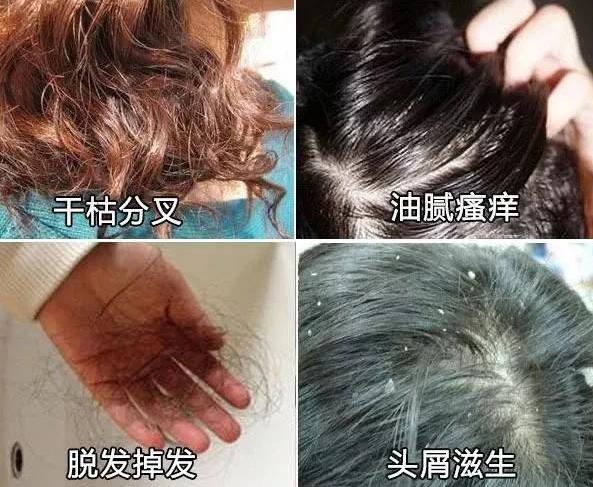 沙宣洗发水蓬松控油去屑,沙宣洗发水去油去屑推荐