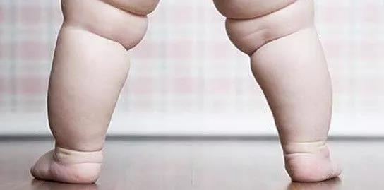 宝宝膝外翻内八最佳矫正年龄,儿童膝外翻需要矫正吗