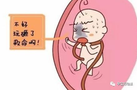 ​孕期周刊  第三十二周