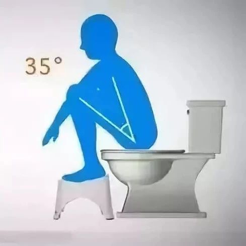 孕期如厕最好的姿势,学习正确如厕的方法