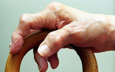 治疗类风湿最好的方法是,类风湿性关节炎症状和治疗方法