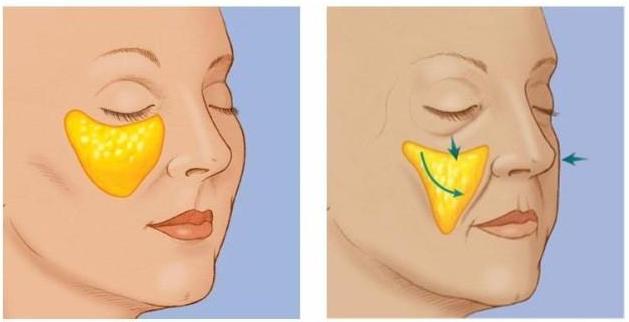 抗衰不再是简单的面部抗衰,抗衰老增加颜值