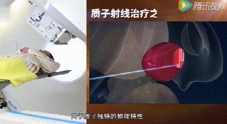 动工！深圳将有全球最准的“质子刀”！李宗伟的鼻咽癌靠它治好