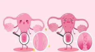 全国肿瘤防治宣传周向女性朋友们的忠告——如何预防妇科肿瘤