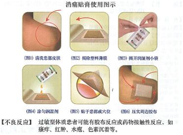 消痛贴膏一般用药方法,消痛贴膏的功能主治