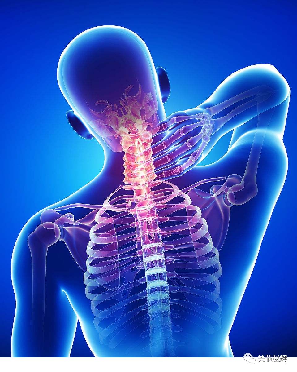 名医一个动作快速解决落枕,赵辉骨科医生