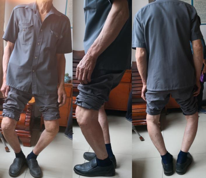 膝关节骨性关节炎症状及治疗,膝关节骨性关节炎诊疗指南下载