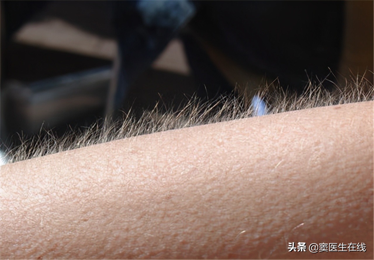 体毛刮掉的好处和坏处,体毛要不要刮掉要一直处理吗